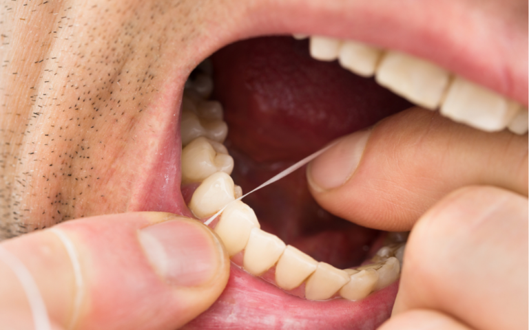 Depois dos 40, Você Usa Fio Dental? Descubra Como Esse Hábito Pode Proteger Seus Dentes e Gengivas