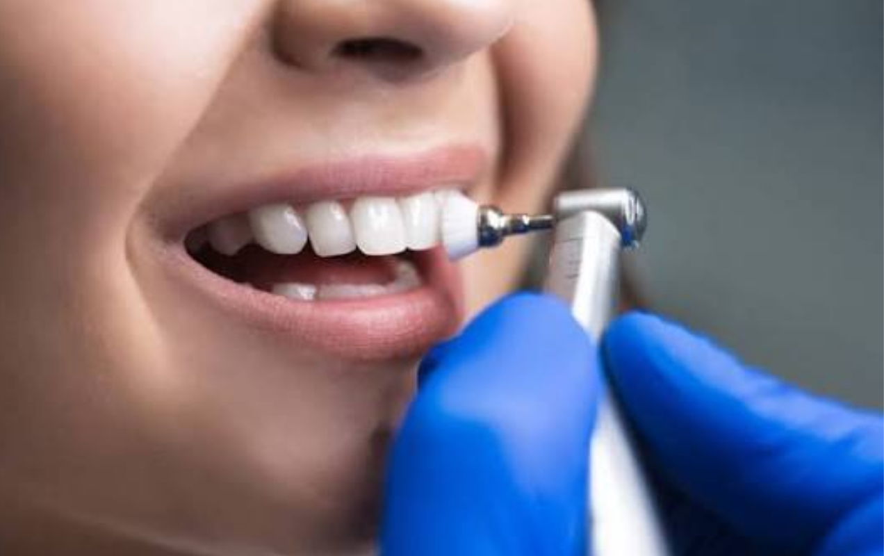 Quantas Vezes Por Ano Fazer Limpeza Dentária?