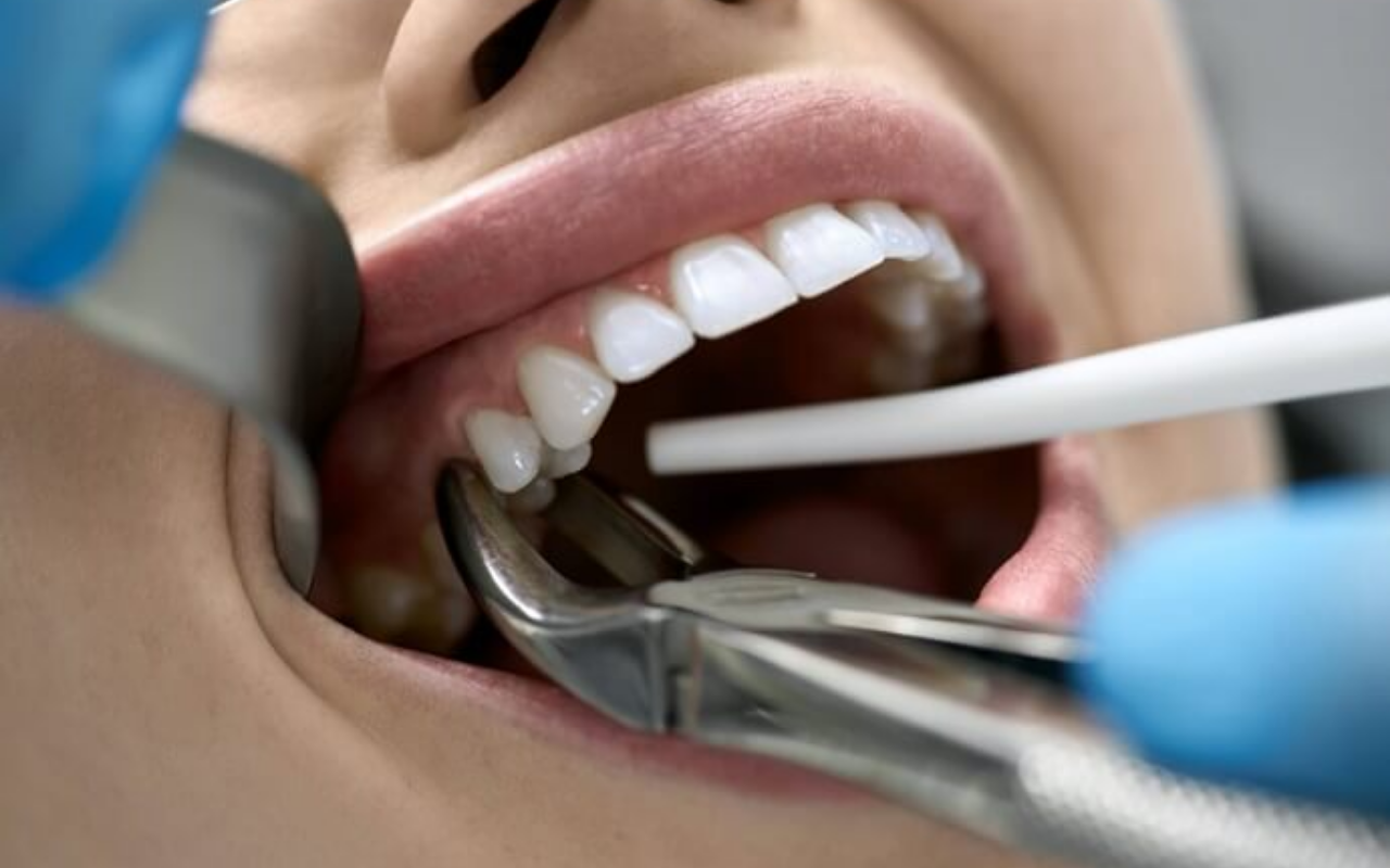 Está com Dor de Dente e Tem Medo de Precisar Extraí-lo? Descubra Quando a Extração Dentária É Realmente Necessária!